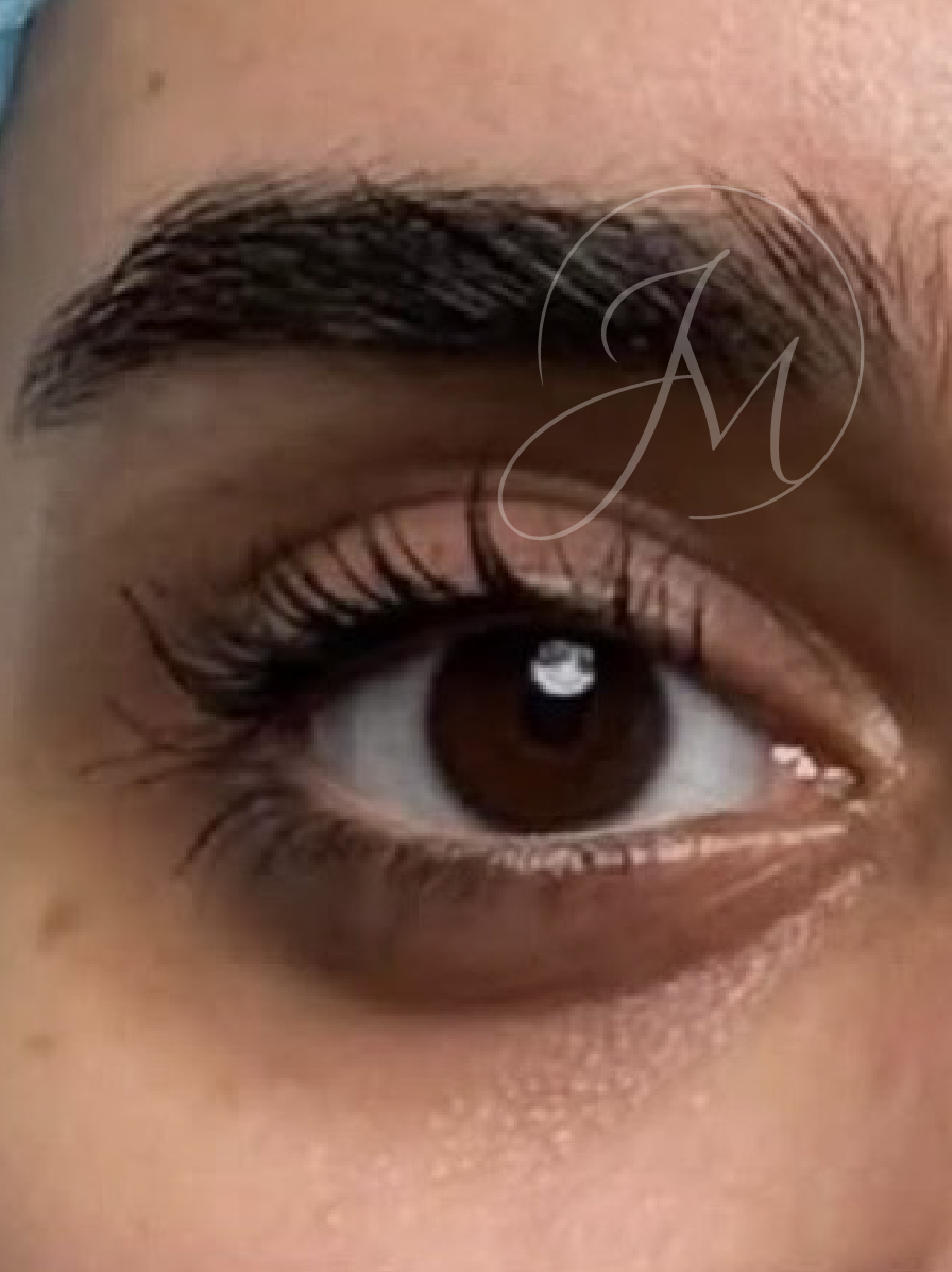 Antes ojeras