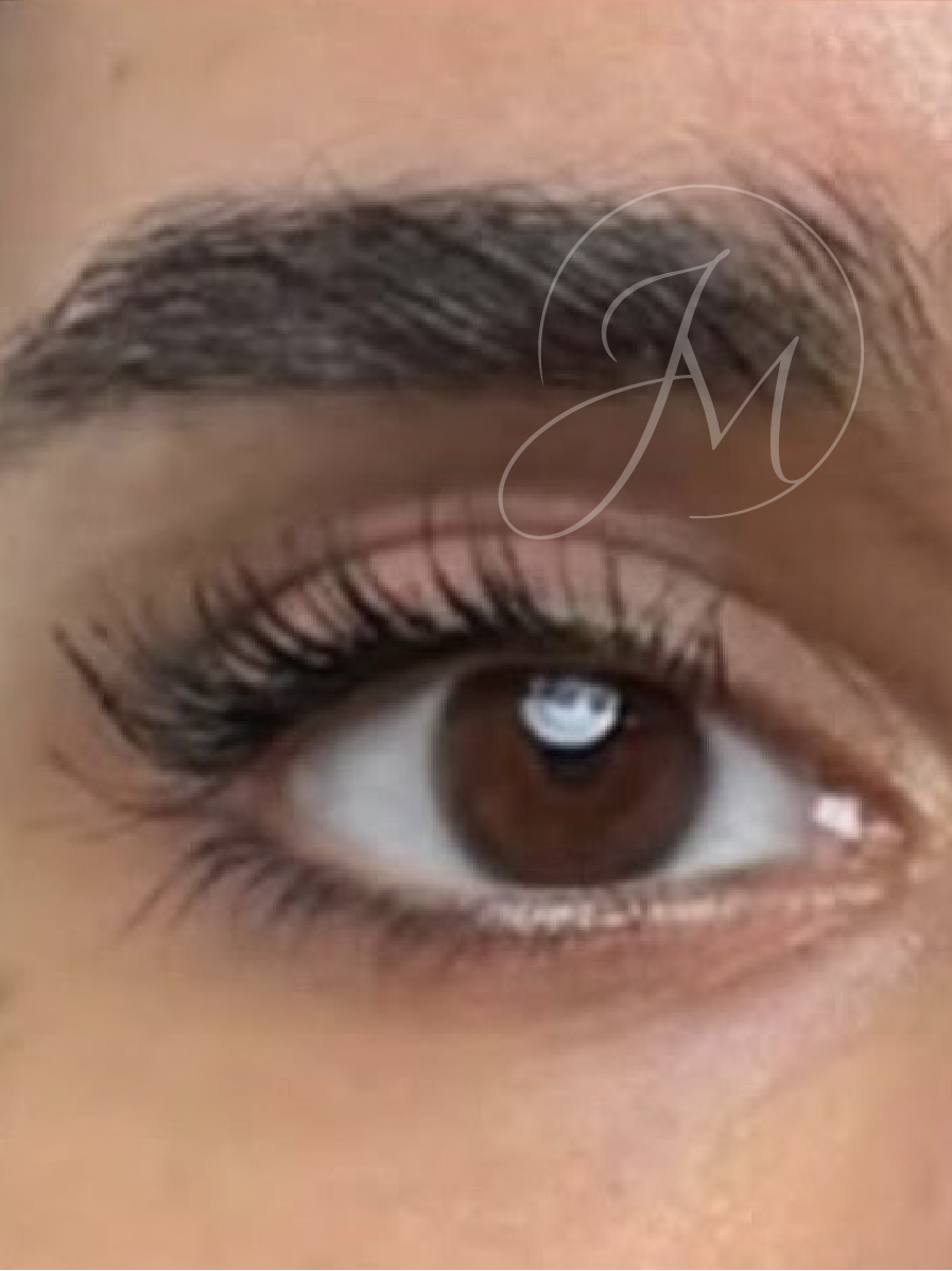 Después ojeras